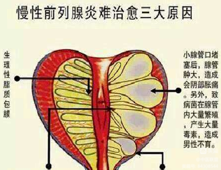 38580304c5a30dd0703d209f9a770de.png